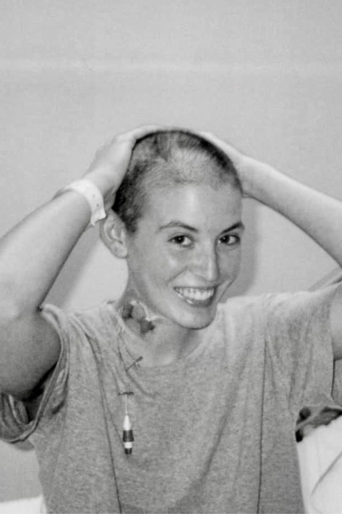 Beth with a shaved head because of cancer treatment